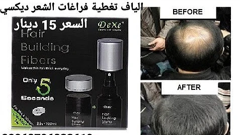 ألياف بناء الشعر Dexe هو منتج مذهل وطبيعي يزيل على الفور مظهر الشعر 